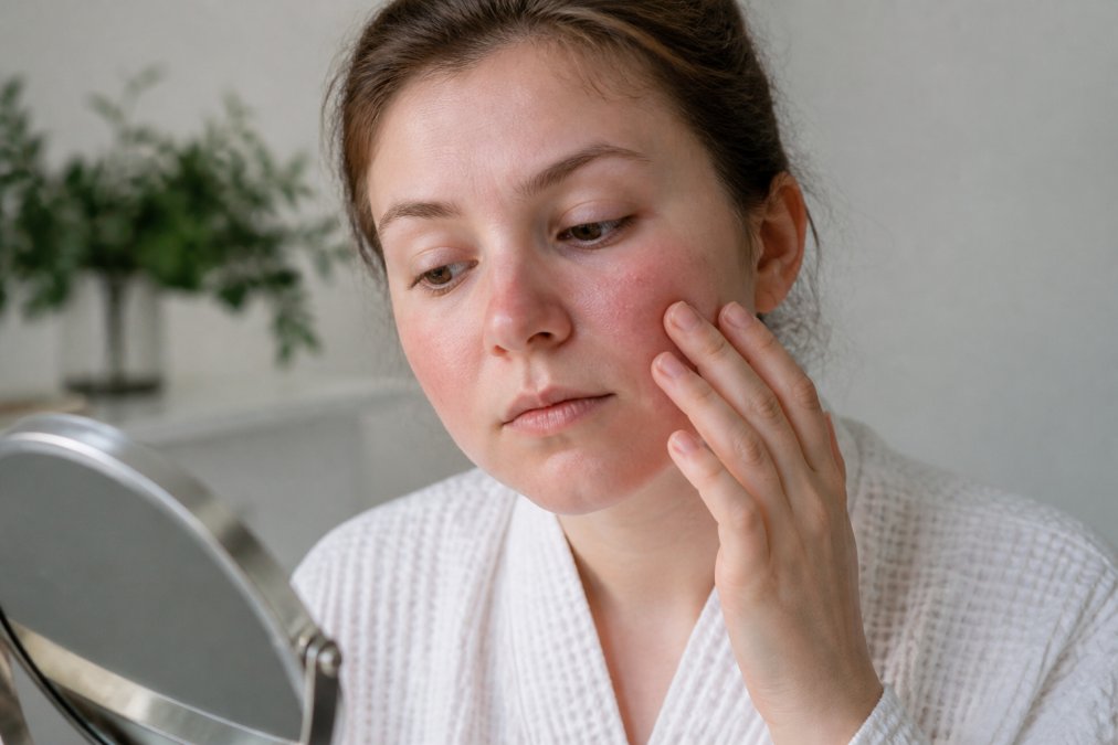 Signs of Compromised Skin Barrier: Repair Guide